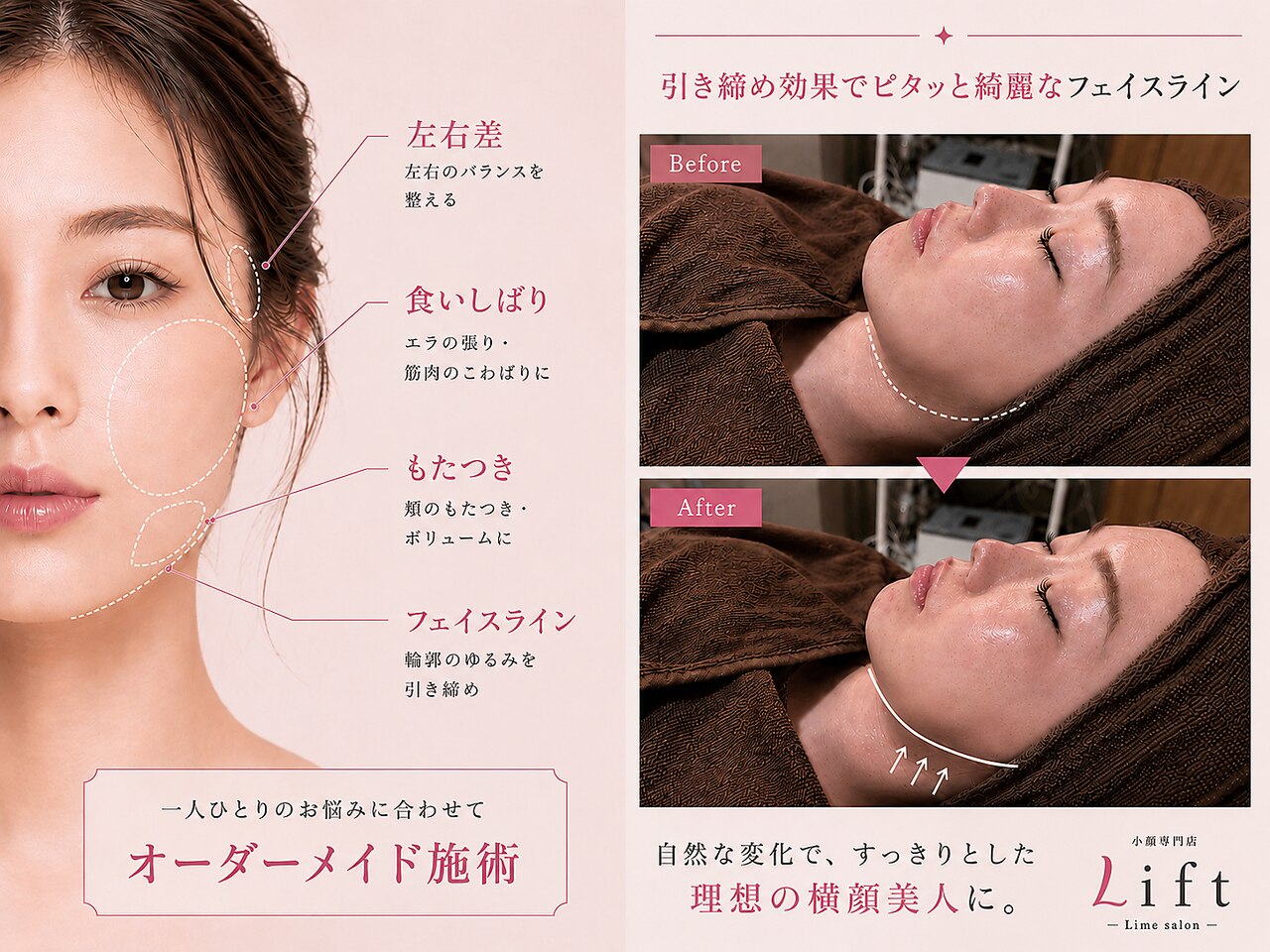 美容【レボリューション】サイズダウン美顔器リフトアップ小顔痩身 リフト 柏(Lift)｜ホットペッパービューティー