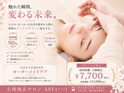 アスト(AST)の写真