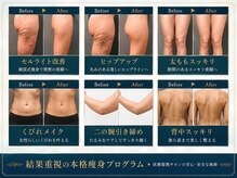 ルネアススパ 南青山(Lune’as Spa)の雰囲気（結果にこだわるボディメイク！脂肪燃焼、ブライダルにも◎）