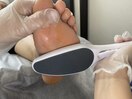 角質ケア