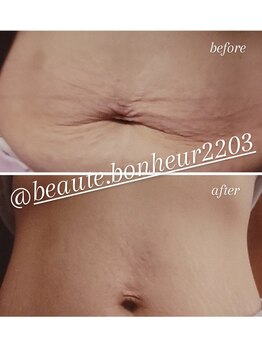 ボーテボナー(Beaute Bonheur)/♪痩身ボディ♪