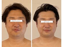 パル コルギサロン(Pal. Korugi salon)/メンズコルギビフォーアフター