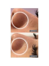 ラ レーヌ(La-leine)/フェイシャルエステ