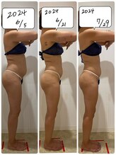 未来型スパエステ サリスパ(SARI SPA)/ビフォーアフター