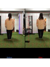 アイボディ(aibody)/お客様のビフォーアフター