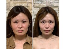 アゴラ/【小顔】豊富な施術実績有り