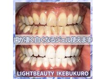 ライトビューティー 池袋店(LightBeauty)