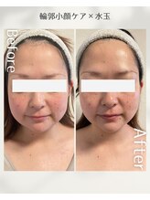 ひっそり美肌構築/3回で印象の変化◎