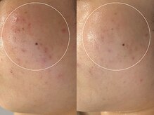 トトノエ(TOTONOE)/クリスティーナフェイシャル