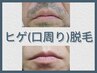 都度払い【men'sヒゲ(口周り)脱毛】2週間に一度通えて最速3～6ヶ月¥5500