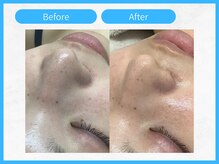 トウメイコガオ 横浜店/