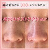 レマンドゥース