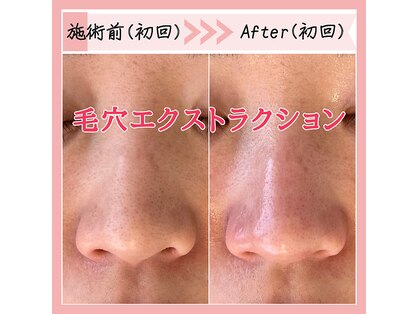 レマンドゥースの写真