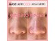 レマンドゥースの写真