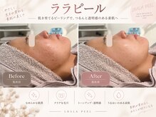 カエラ(KAELA)
