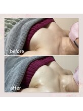 セレーネ(Selene)/お客様before.after