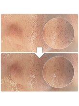 ペイジ(peige)/【peige】症例写真