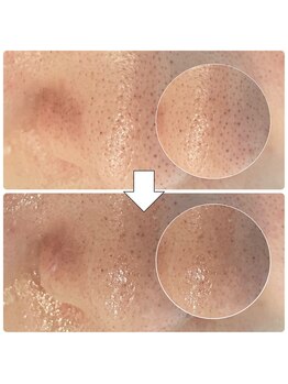 ペイジ(peige)/【peige】症例写真