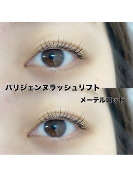 レディエント(Radiant)/☆メーテルロッド☆