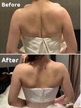 ラヴィニティ 自由が丘店(Lavinity)/【ブライダル】お客様ビフォアフ