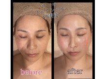 プリュマージュ(Plumage)の雰囲気（期待以上の仕上りで大満足◎キュッと引き締めサーモフェイシャル）