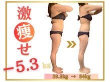 ハイパーナイフ×キャビで代謝UP！全身スッキリ[ダイエット]