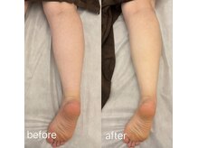 マハロ(mahalo)/むくみ撃退