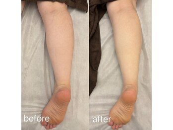 マハロ(mahalo)/むくみ撃退