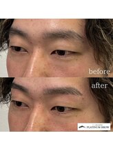 プラチナムブロウ 長岡店(PLATINUM BROW)/美眉スタイリングのお客様　20代