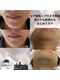 マウム(Maum)の写真/看護師監修◎ヒゲ脱毛で清潔感と自信を♪