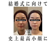 キュープ 鹿児島伊集院店(Qpu)/