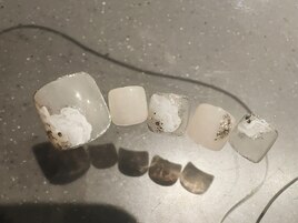 フット定額ネイル