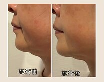 facial salon non.