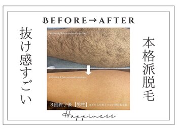 ハピネス 大阪梅田店(Happiness)/1回目から変わり3回目で確信