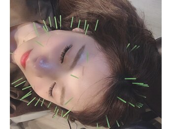 ベルシャルム 吉田院(Bell Charme)