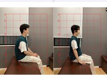 摂津本山駅前鍼灸整骨院/ビフォーアフターになります！