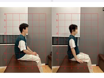 摂津本山駅前鍼灸整骨院/ビフォーアフターになります！
