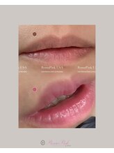 凰湖/【メラニンケア】ローマピンク