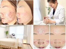 ビューティーホリック 蘇我店(BEAUTY HOLIC)