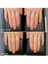 ネイルズ アヴァンティ(Nails Avanti)/ハンドエステ