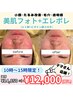 【働くママ応援】美肌フォトx美容液導入¥14,850→¥12,000 【何度でも使える】
