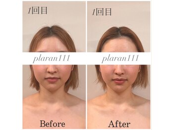 ボディヒーリングアンド小顔美容矯正 プララン/小顔矯正ビフォーアフター