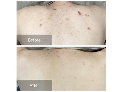 エミルカ 鹿児島店(EMILUCA)の写真