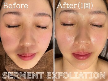 ココモンド(COCOMONDO)/セルマン艶肌ピーリング