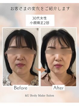 アンドユー(&U)/