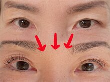 アイラッシュバーリー バイ ノブグループ(EYE LASH BARLEY by NOB GROUP)/目が開く！感動体験