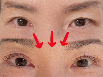 アイラッシュバーリー バイ ノブグループ(EYE LASH BARLEY by NOB GROUP)/目が開く!感動体験