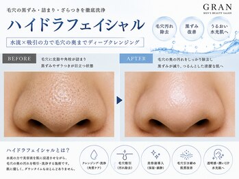 グラン(GRAN)/毛穴洗浄しましょう！