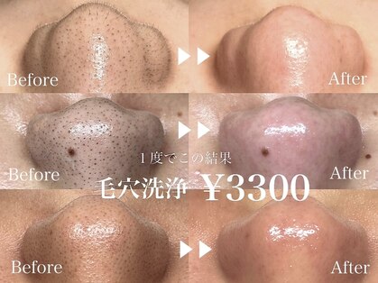 ディエール(Diailes)の写真
