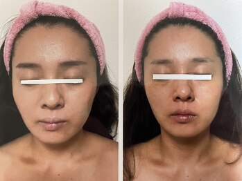 ダルセーニョ/ダルセーニヨ小顔コルギサロン